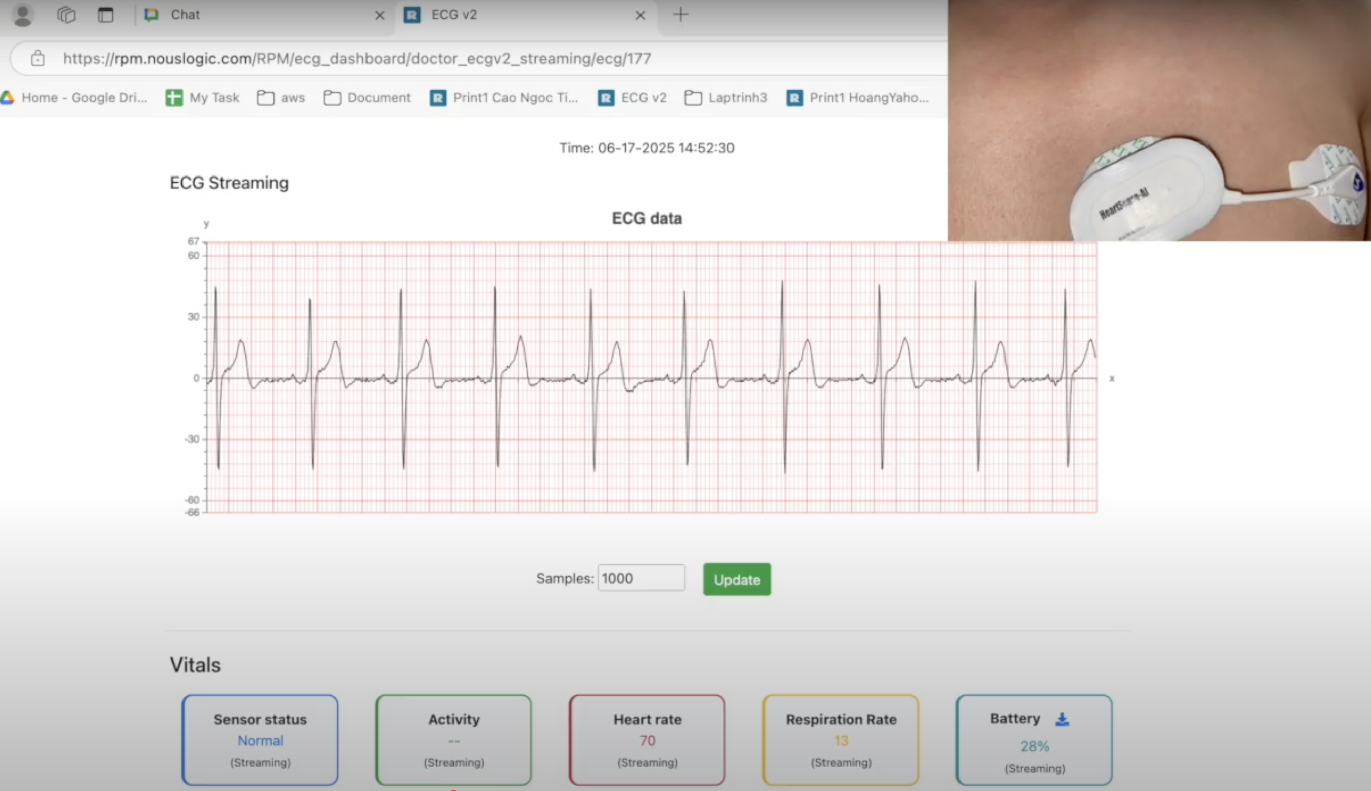 dashboard_ecg